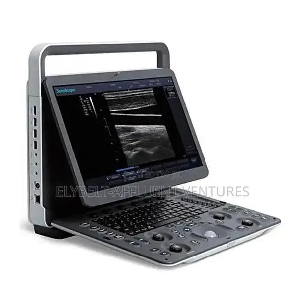 Sonoscape E2 Color Doppler Ultrasound Machine · Photo 2
