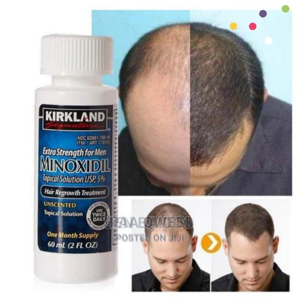 Original Kirkland Minoxidil · Photo 1