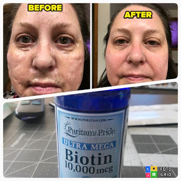 Utra Mega Biotin · Photo 1