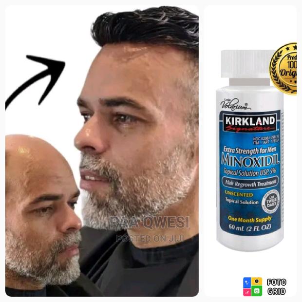 Undiluted Minoxidil · Photo 1