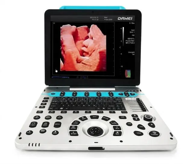 Ultrasound Scan Machine (Dawe) · Photo 1
