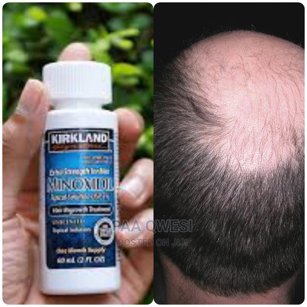 Kirkland Minoxidil (Original 100%) · Photo 1