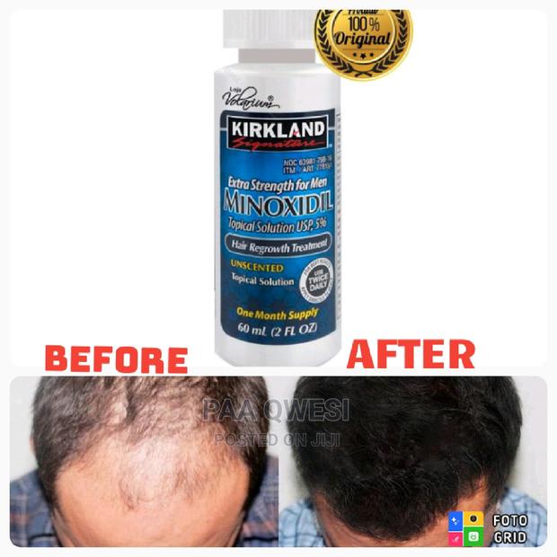 Kirkland Topical Solution. · Photo 1