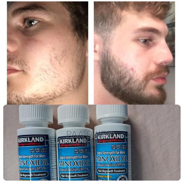 Kirkland Beard and Hairline Loss Oil. · Photo 1