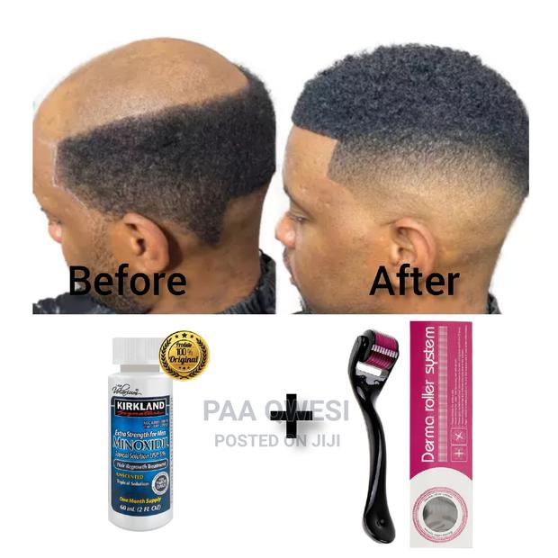 Derma Roller System Kirkland Undiluted Oil · Photo 1