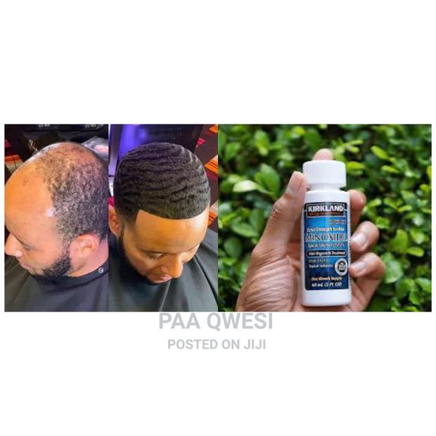 Kirkland Minoxidil Hair Growth Treatment · Photo 1