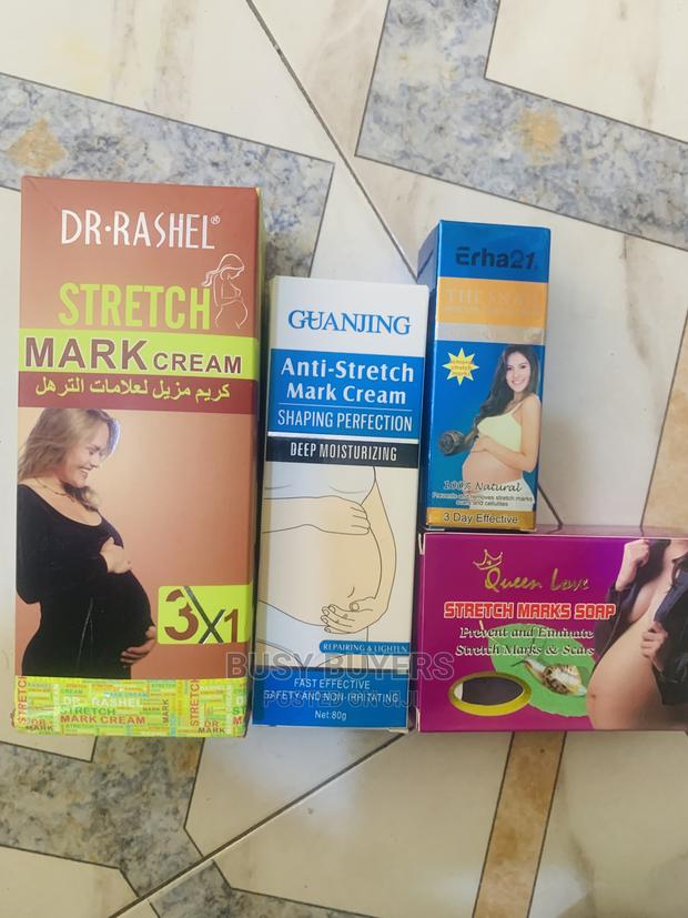 Stretch Marks Set · Photo 1