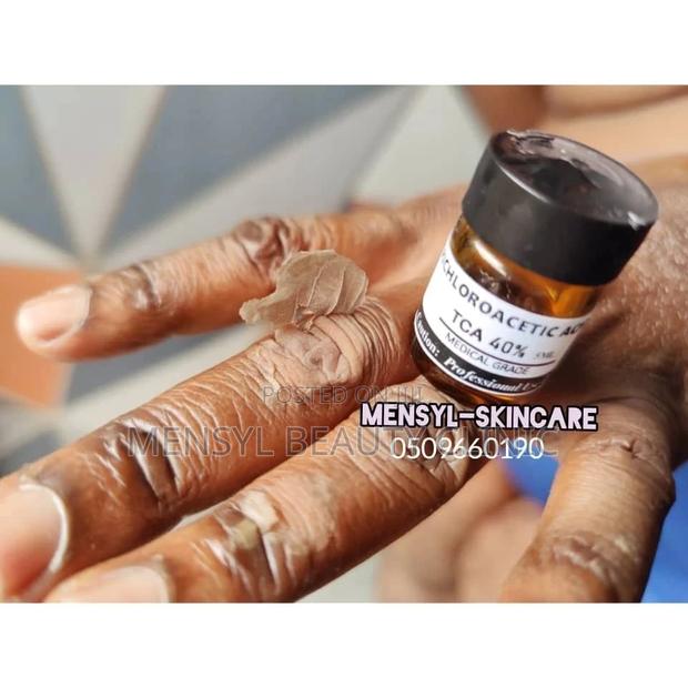 Tca Chemical Peel Solution · Photo 2