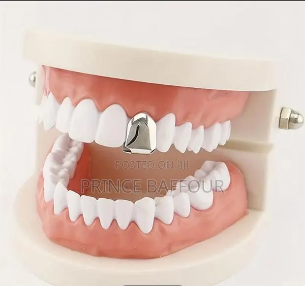 Hip Hop Teeth / Simple Gold Grillz · Photo 2