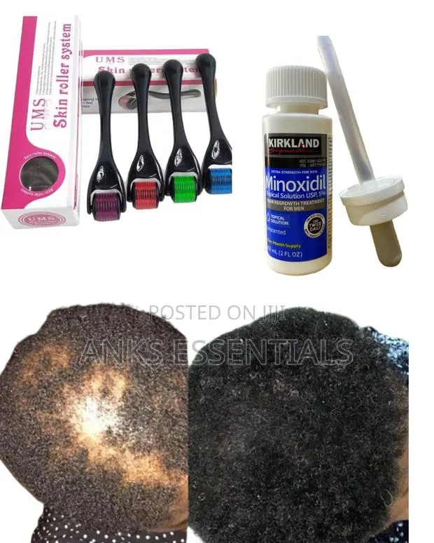 Kirkland Hair Growth Kit With Derma Roller – Fast Results · Photo 1
