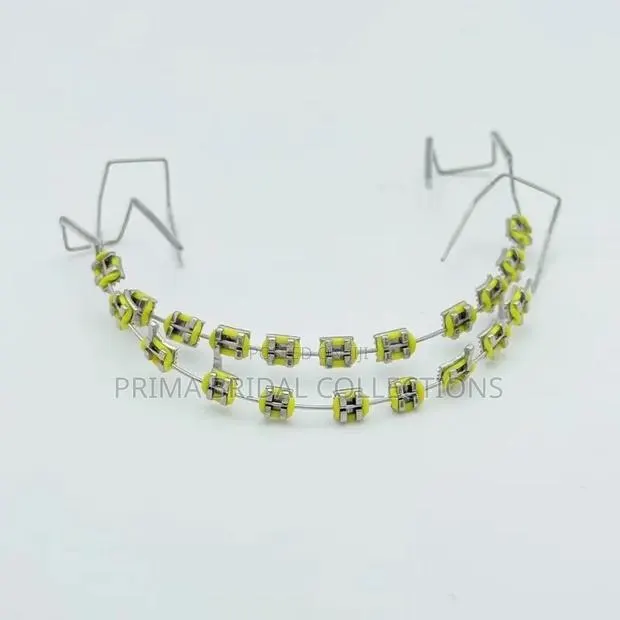 Fashion Braces · Photo 1