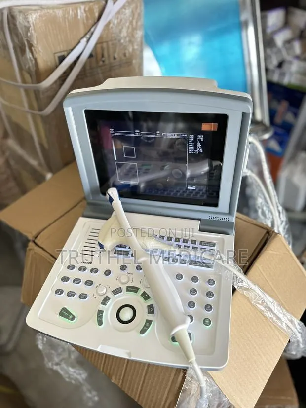 Portable Ultrasound Machine (With Convex and Transvaginal Probes) · Photo 1