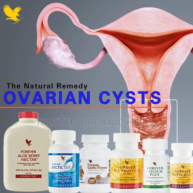 Natural Solution for Ovarian Cyst · Photo 1