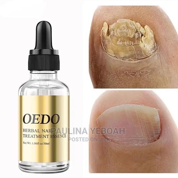 Nail Treatment Oil · Photo 2