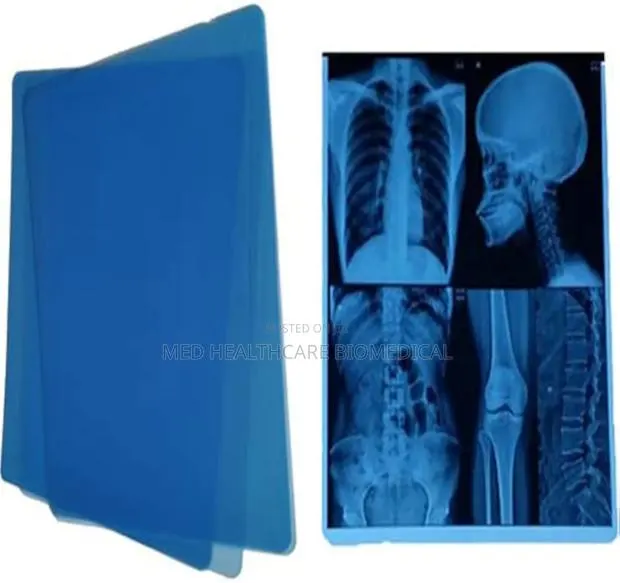 X-Ray Blue Films · Photo 1