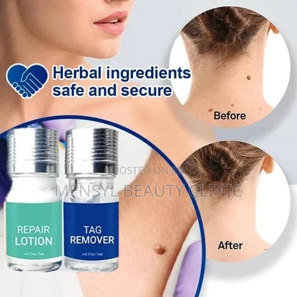 Medical Grade Skin Tag, Genital Wart and Mole Removal 2 in 1 · Photo 3