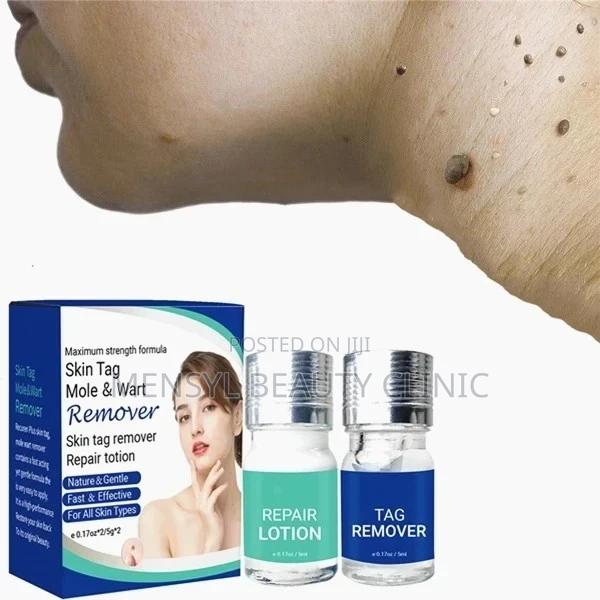 Medical Grade Skin Tag, Genital Wart and Mole Removal 2 in 1 · Photo 1