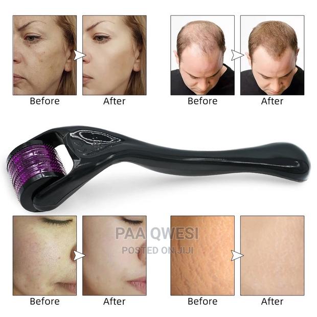 Derma Roller Growth Device {1.5mm} · Photo 1