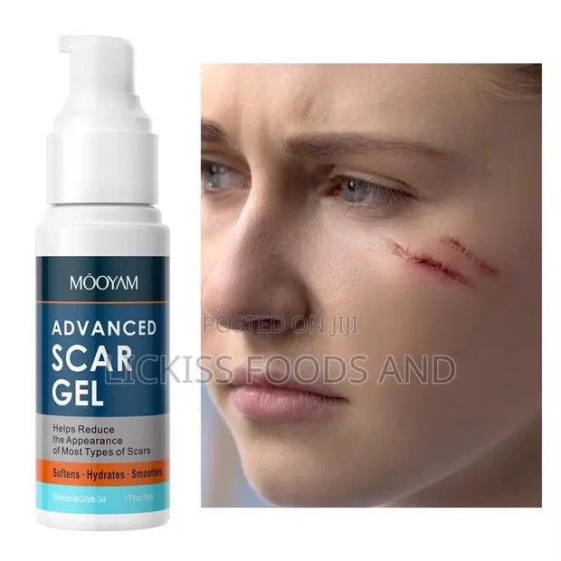 Stretch Marks and Scar Removal Gel · Photo 1