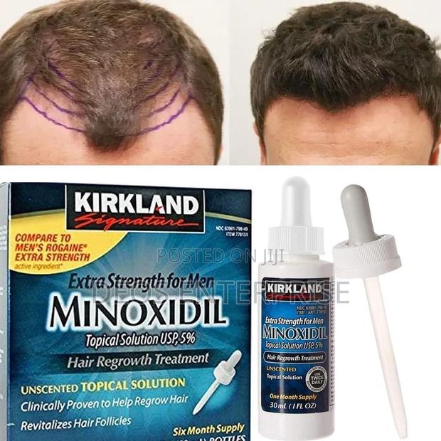 Kirkland Minoxidil Oil for Baldness · Photo 1