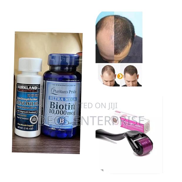 Kirkland Minoxidil Biotin Derma Roller for Growing Hair · Photo 1