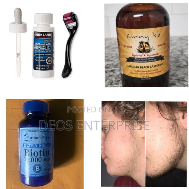 Combo for Hair Loss · Photo 1