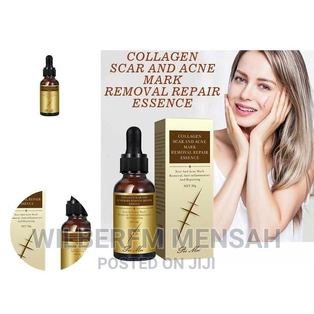 Collagen Scar Acne Removal Gel
