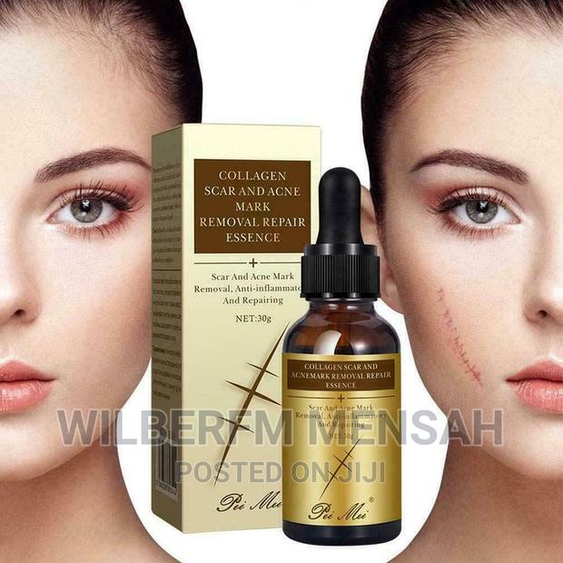 Collagen Scar Acne Removal Gel · Photo 2