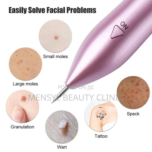 Plasma Pen for Skin Tag Removal,Stretch Marks and Tightening · Photo 2