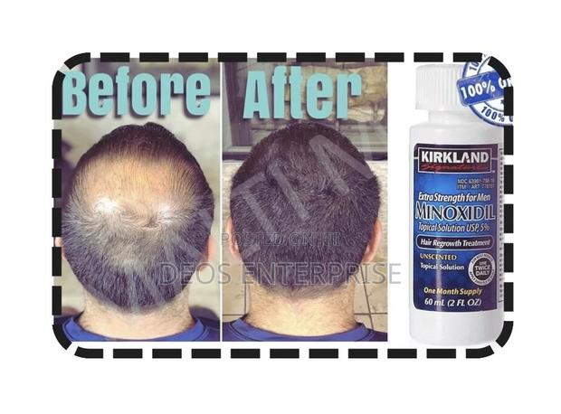 Kirkland Minoxidil Extra Strength for Beard Growth · Photo 1