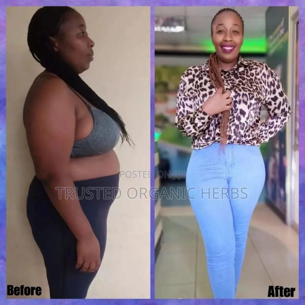 Real Testimonies of Forever C9 Weight Loss Products · Photo 7