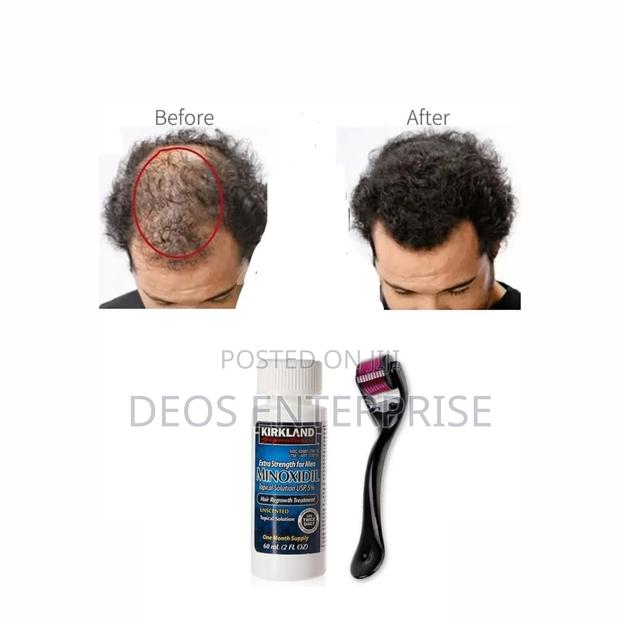 Beard,Hairline and Baldness Super Combo · Photo 1