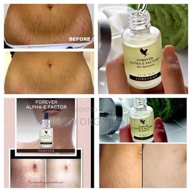 Best Stretch Marks Removal Products /Forever Living Products · Photo 1