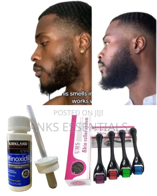 Kirkland Minoxidil + Derma Roller – Complete Hair Regrowth Package · Photo 1