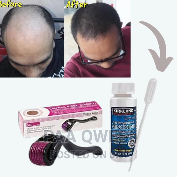 Rapid Hair Regrowth Combo · Photo 1