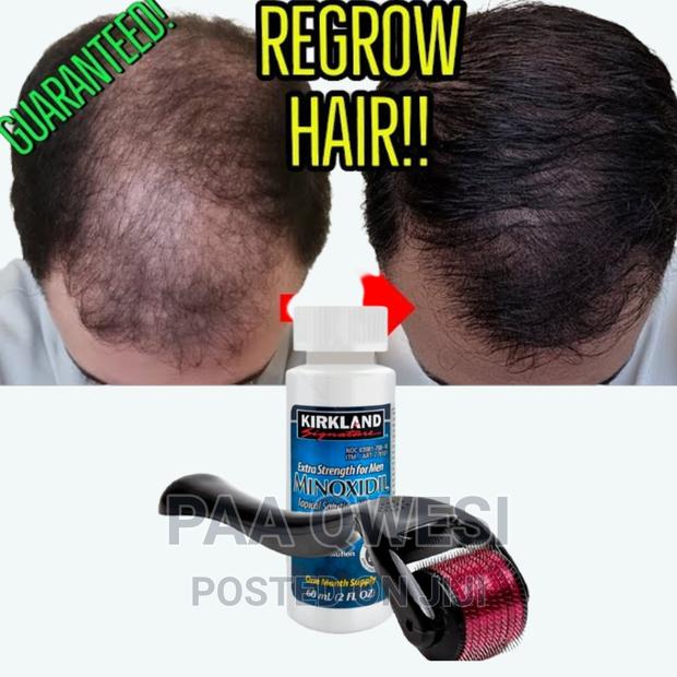 Men Hair Regrowth Product · Photo 1