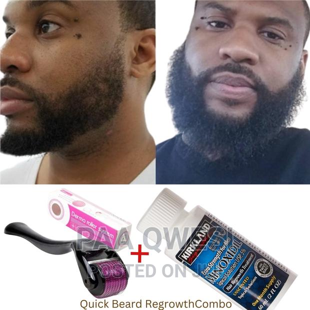 Beard Regrowth Product for Men. · Photo 1