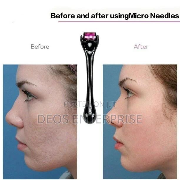 Derma Roller for Skin · Photo 1