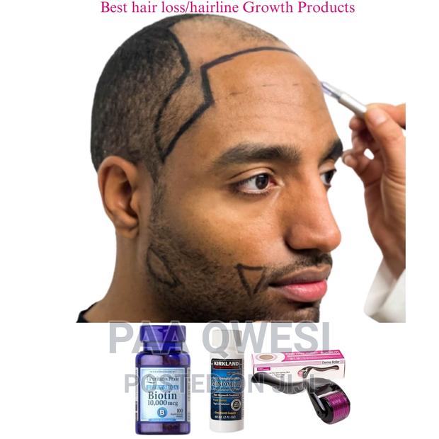 Rapid Hair Loss /Hairline Regrowth Products(Men) · Photo 1