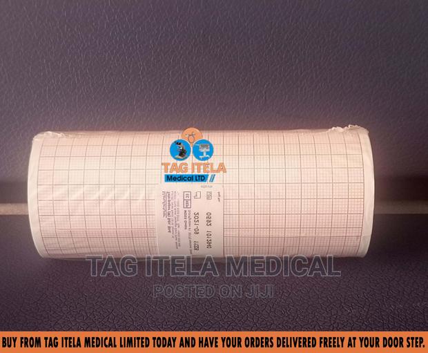 ECG Paper (Channel 6) · Photo 2