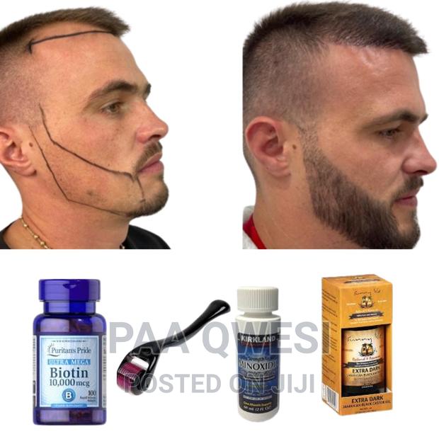 Hairline Loss Full Beard Growth Product {100% Guaranteed} · Photo 1