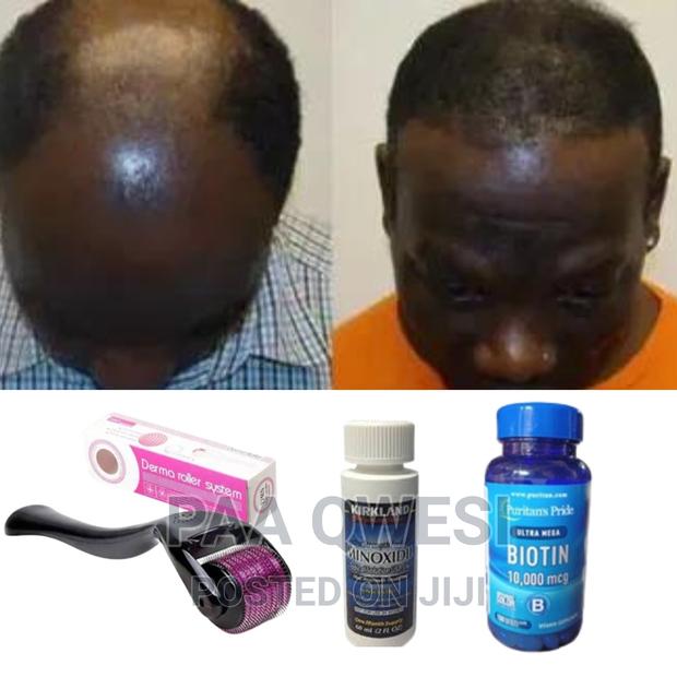 “Kirkland Minoxidil:The Ultimate Haircare Secret” · Photo 1