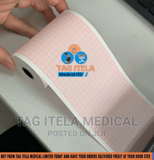 ECG Paper (Channel 3) · Photo 1