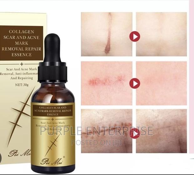 TCM Scar Removal Oil · Photo 1