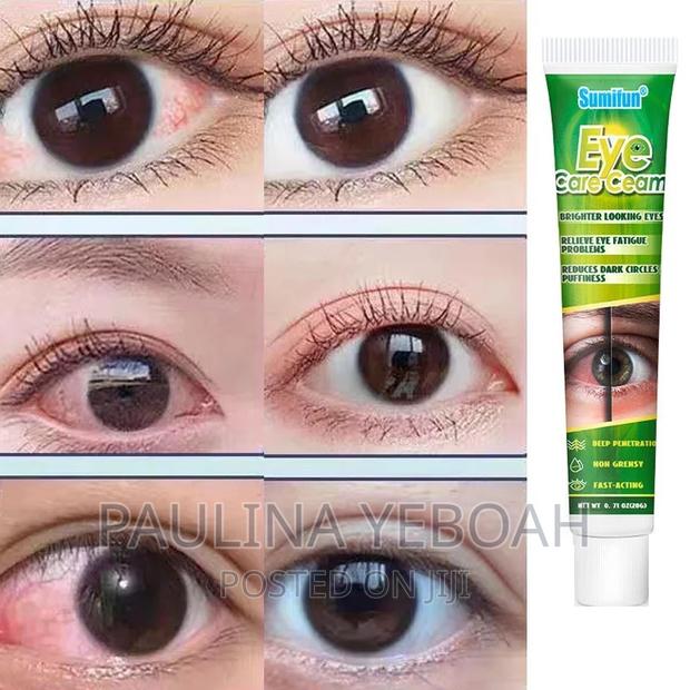 Eye Whitening Cream · Photo 5