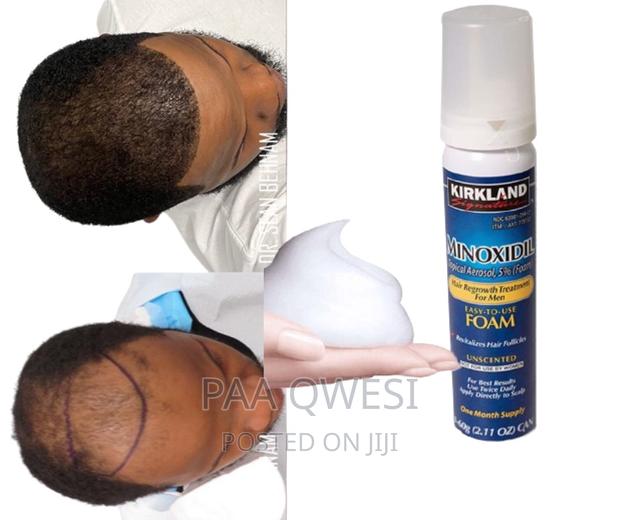 Kirkland Foam For Hair Growth · Photo 1