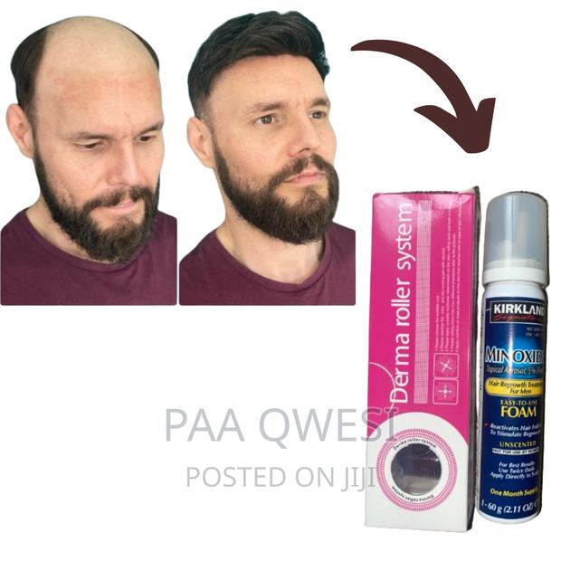 Super Combo for Baldness and Hairline Loss · Photo 1