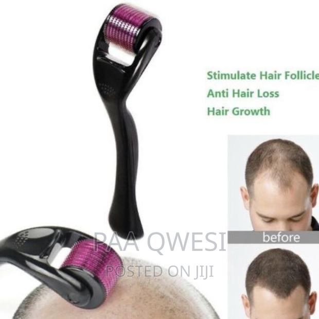 Derma Roller for Baldness Treatment · Photo 1