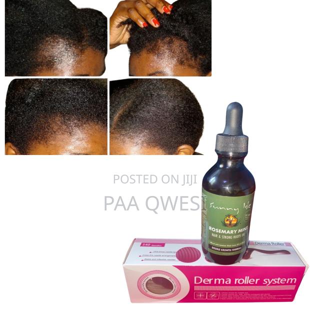 Rosemary Mint and Derma Roller · Photo 1