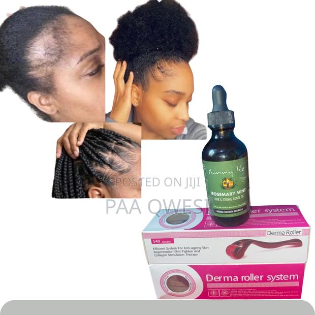 Derma Roller 1.5mm Rosemary Oil for Hair Edges · Photo 1